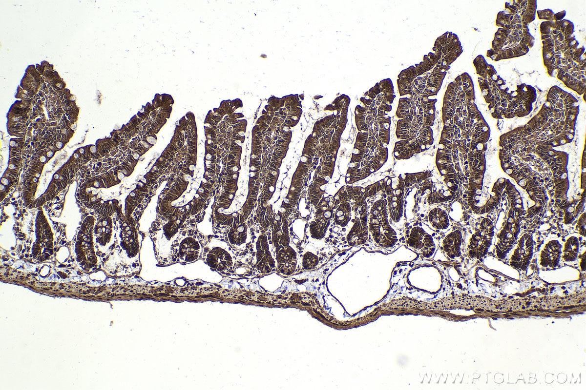 Immunohistochemical analysis of paraffin-embedded rat small intestine tissue slide using KHC2025 (RIPK3 IHC Kit).