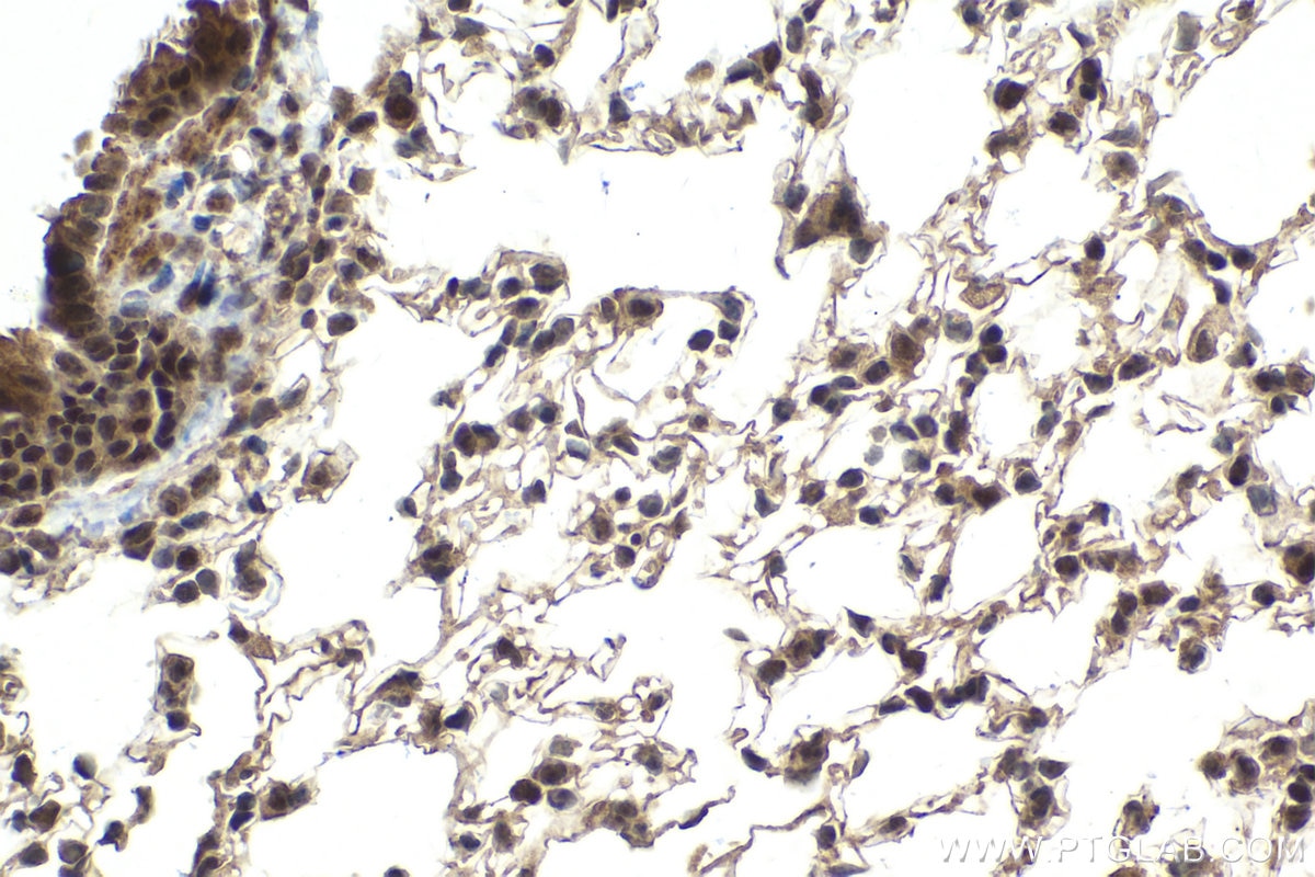 Immunohistochemical analysis of paraffin-embedded mouse lung tissue slide using KHC2025 (RIPK3 IHC Kit).