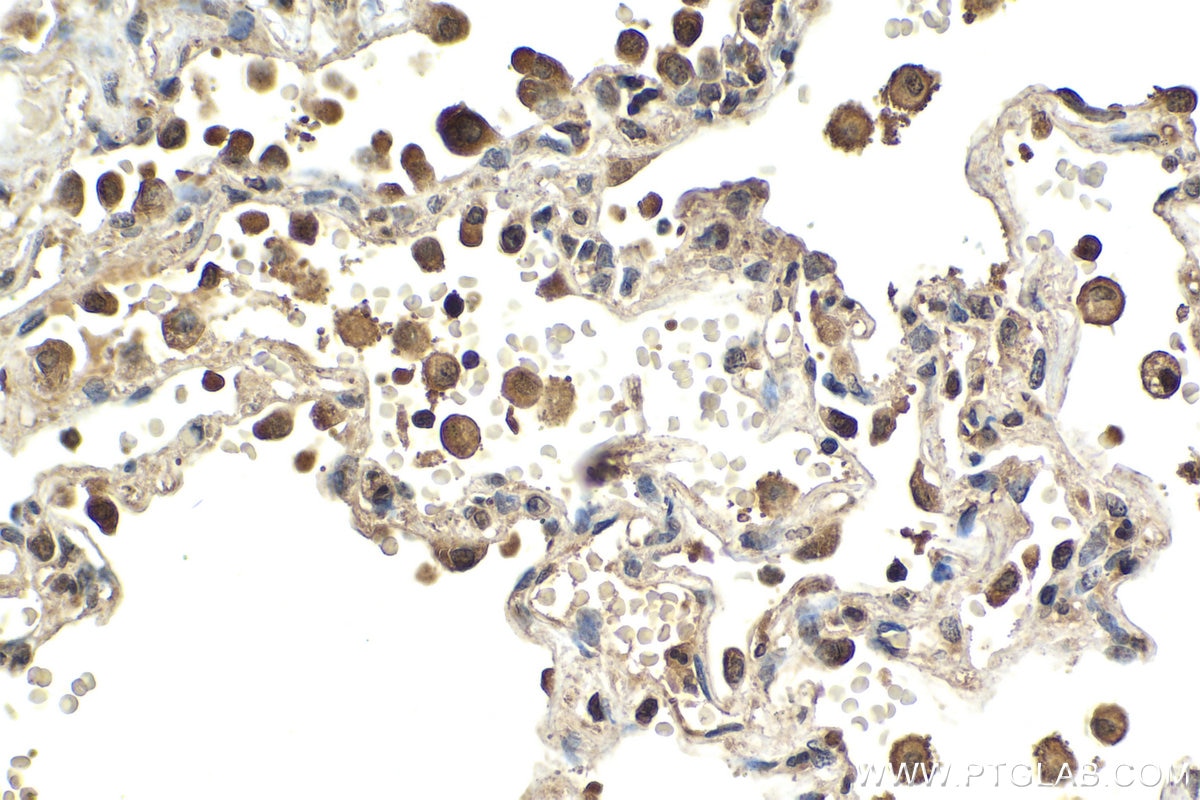 Immunohistochemical analysis of paraffin-embedded human lung tissue slide using KHC2025 (RIPK3 IHC Kit).