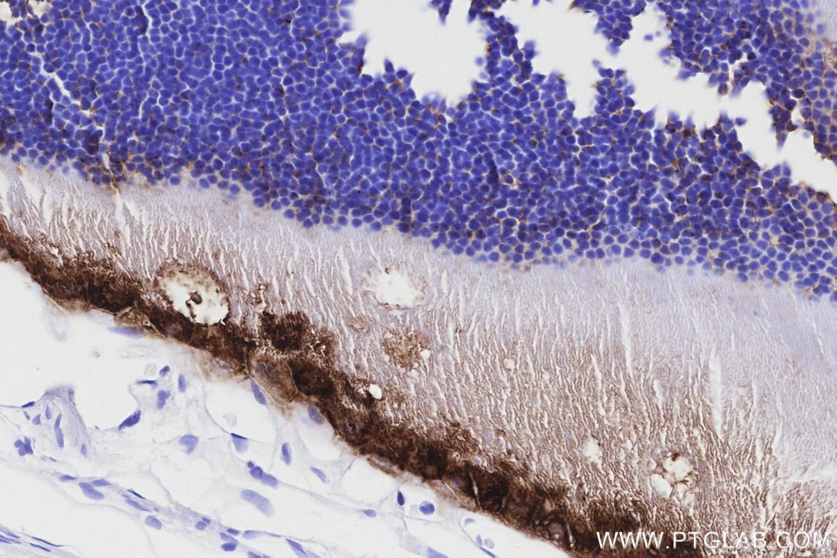Immunohistochemical analysis of paraffin-embedded rat eye tissue slide using KHC3180 (RLBP1 IHC Kit).