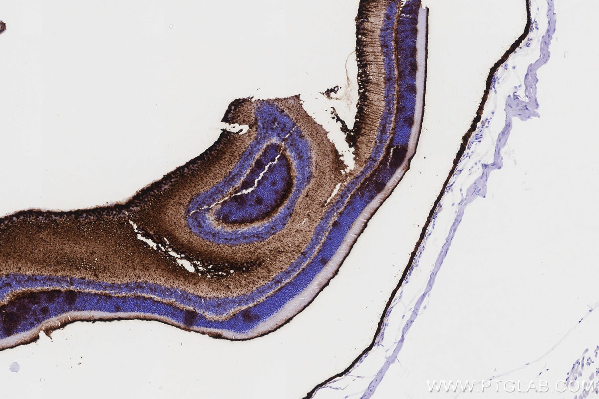 Immunohistochemical analysis of paraffin-embedded mouse eye tissue slide using KHC3180 (RLBP1 IHC Kit).