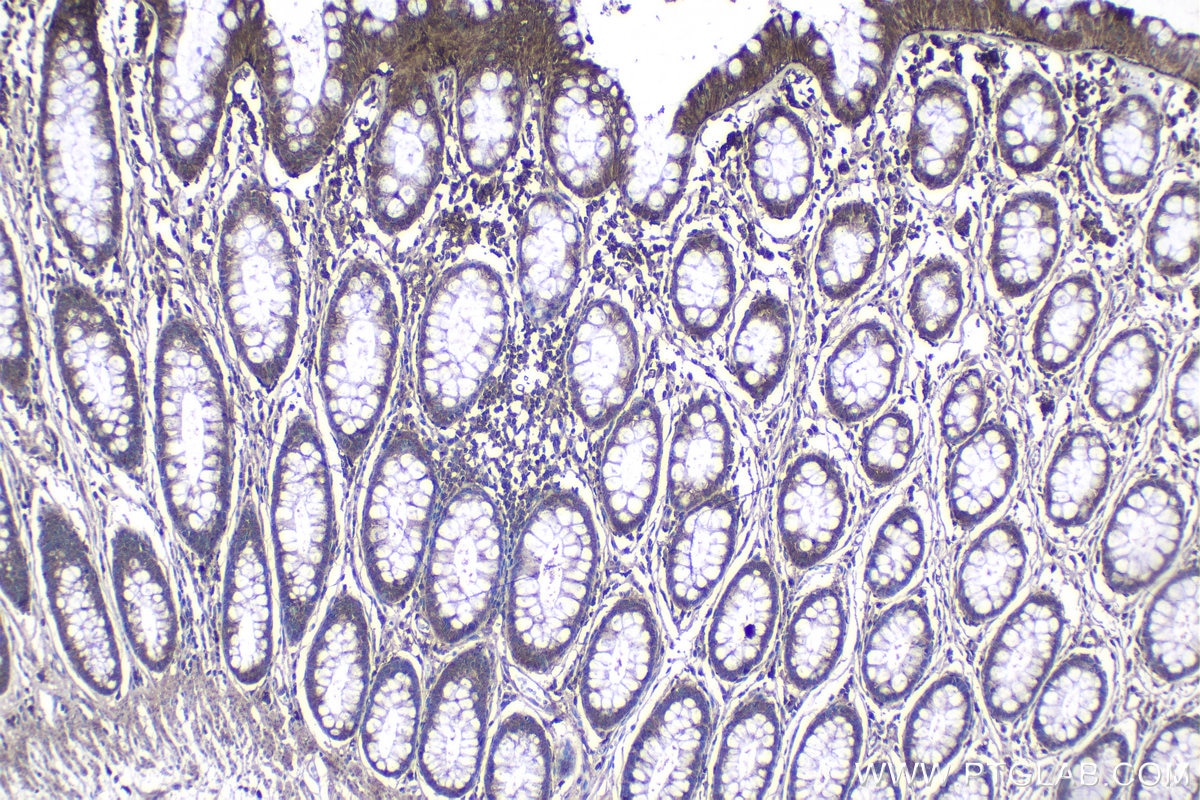 Immunohistochemical analysis of paraffin-embedded human colon tissue slide using KHC1143 (RNASET2 IHC Kit).