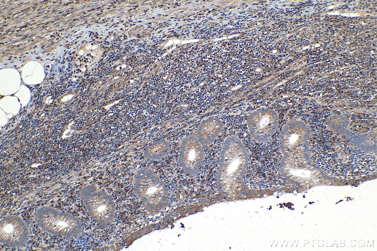 Immunohistochemical analysis of paraffin-embedded human appendicitis tissue slide using KHC1143 (RNASET2 IHC Kit).