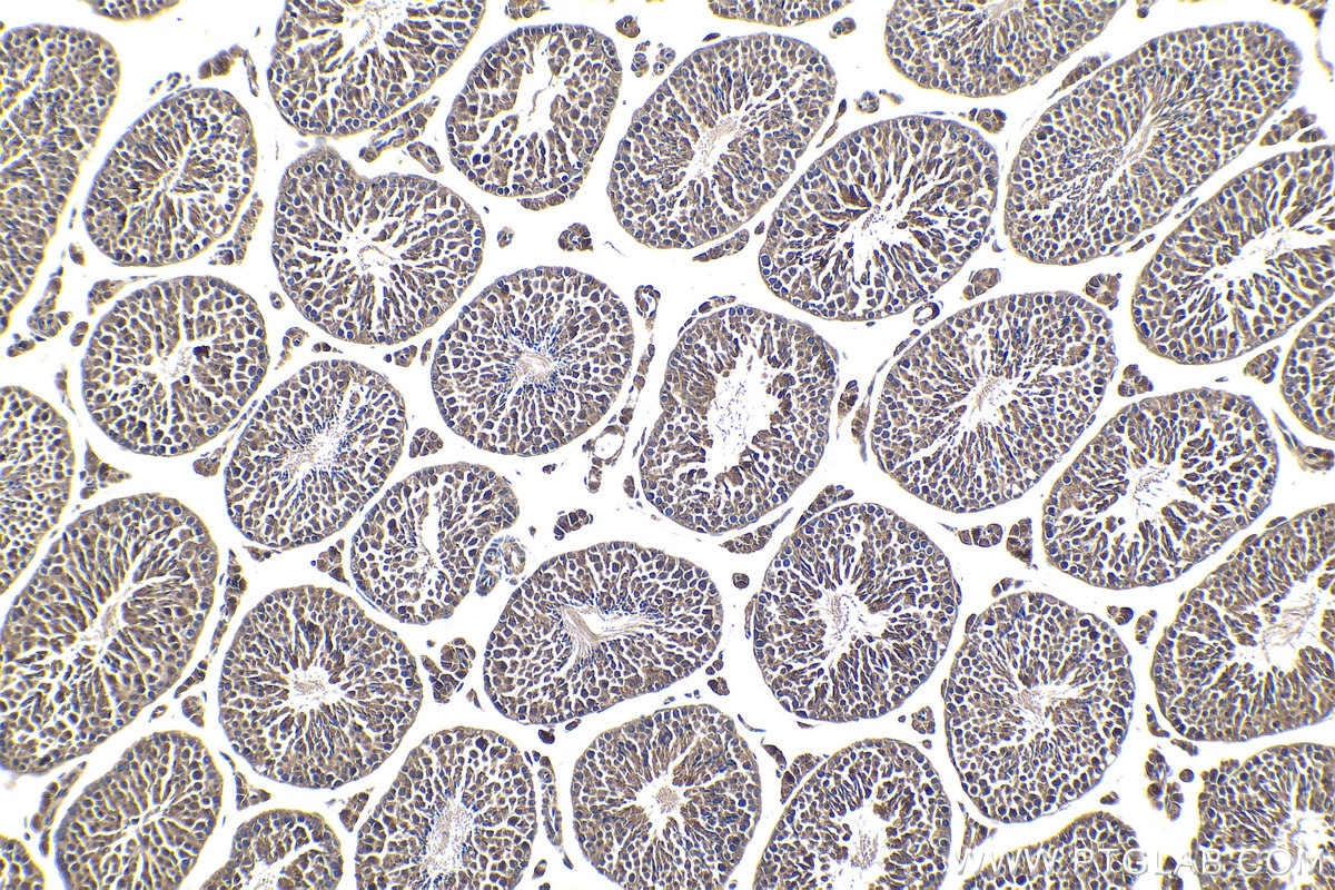 Immunohistochemical analysis of paraffin-embedded mouse testis tissue slide using KHC1831 (RNF10 IHC Kit).