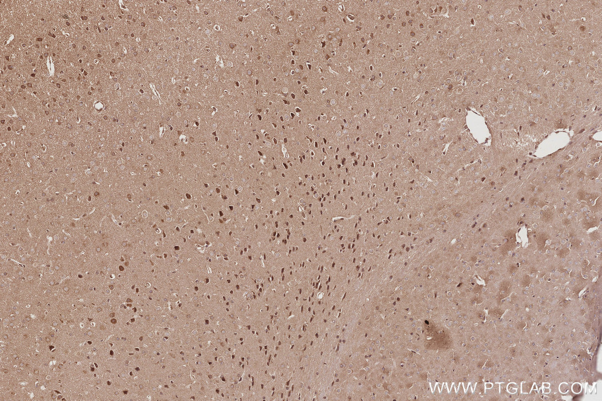 Immunohistochemical analysis of paraffin-embedded mouse brain tissue slide using KHC3038 (RNF112 IHC Kit). Immunohistochemical analysis of paraffin-embedded mouse brain tissue slide using KHC3038 (RNF112 IHC Kit).