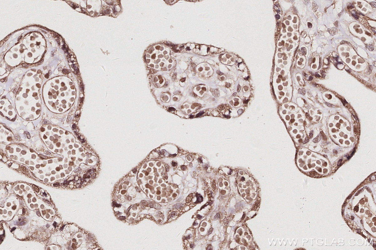 Immunohistochemical analysis of paraffin-embedded human placenta tissue slide using KHC3038 (RNF112 IHC Kit). Immunohistochemical analysis of paraffin-embedded human placenta tissue slide using KHC3038 (RNF112 IHC Kit).