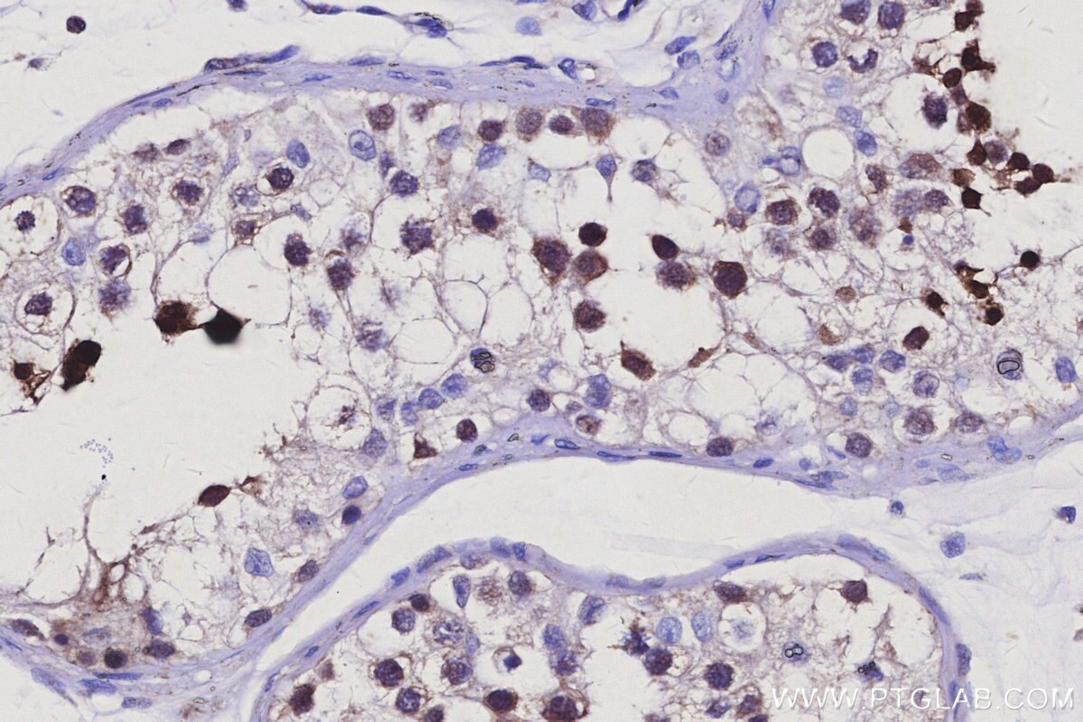 Immunohistochemical analysis of paraffin-embedded human testis tissue slide using KHC3082 (RNF114 IHC Kit). Immunohistochemical analysis of paraffin-embedded human testis tissue slide using KHC3082 (RNF114 IHC Kit).