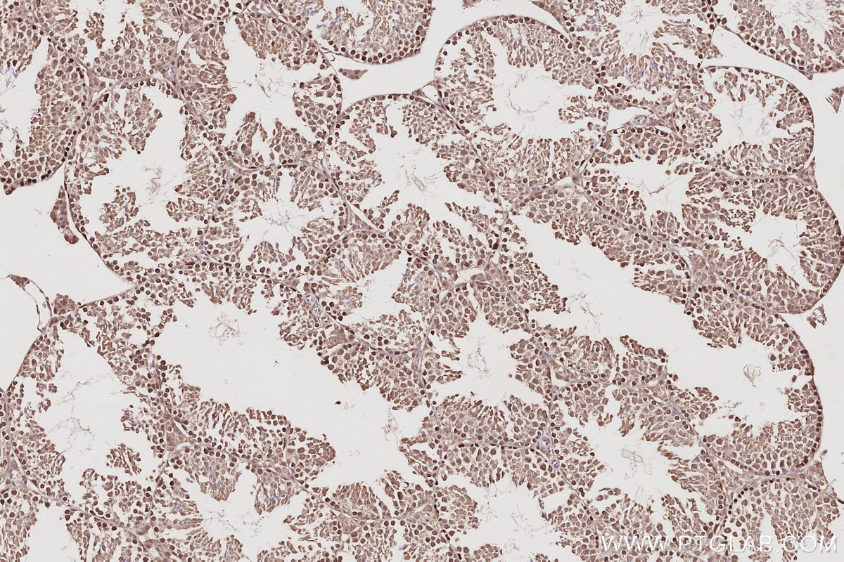 Immunohistochemical analysis of paraffin-embedded mouse testis tissue slide using KHC3082 (RNF114 IHC Kit). Immunohistochemical analysis of paraffin-embedded mouse testis tissue slide using KHC3082 (RNF114 IHC Kit).