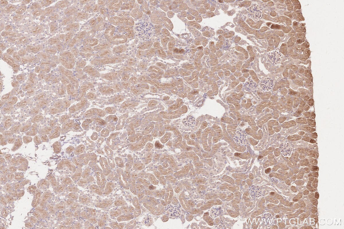 Immunohistochemical analysis of paraffin-embedded mouse kidney tissue slide using KHC2566 (RNF123 IHC Kit).