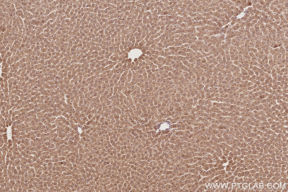Immunohistochemical analysis of paraffin-embedded rat liver tissue slide using KHC2871 (RNF126 IHC Kit).