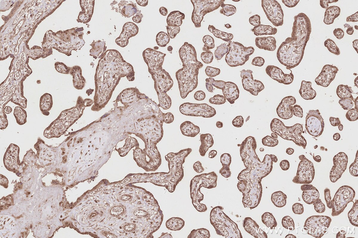 Immunohistochemical analysis of paraffin-embedded human placenta tissue slide using KHC2871 (RNF126 IHC Kit).