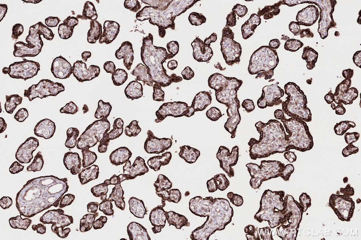Immunohistochemical analysis of paraffin-embedded human placenta tissue slide using KHC2730 (RNF139 IHC Kit).