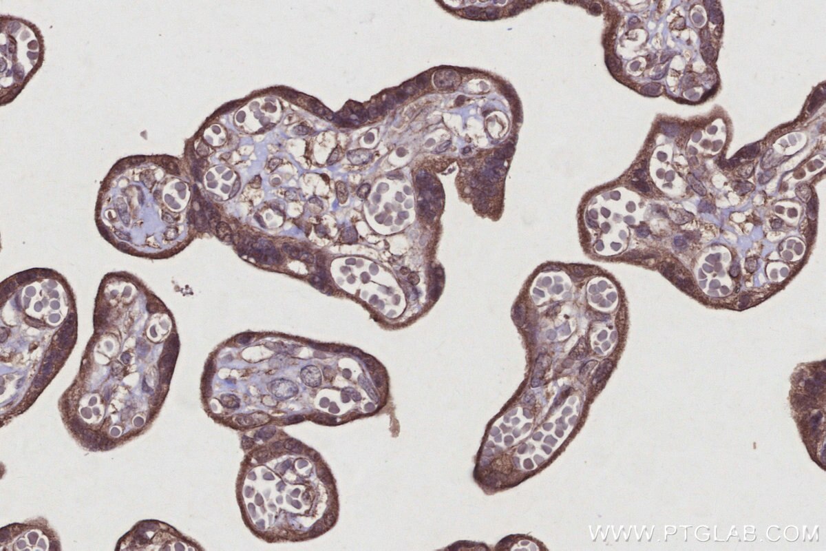 Immunohistochemical analysis of paraffin-embedded human placenta tissue slide using KHC2923 (RNF167 IHC Kit).