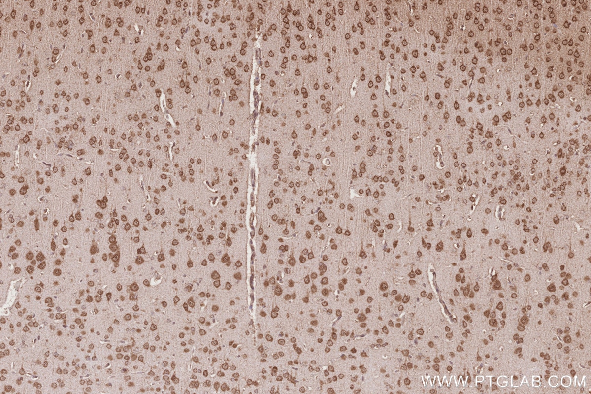 Immunohistochemical analysis of paraffin-embedded rat brain tissue slide using KHC2773 (RNF34 IHC Kit).