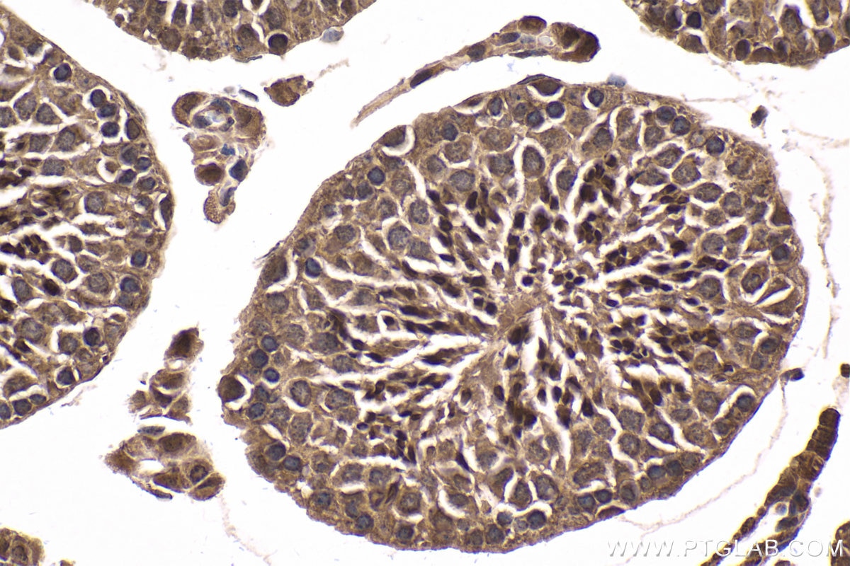 Immunohistochemical analysis of paraffin-embedded mouse testis tissue slide using KHC1652 (RNF4 IHC Kit).