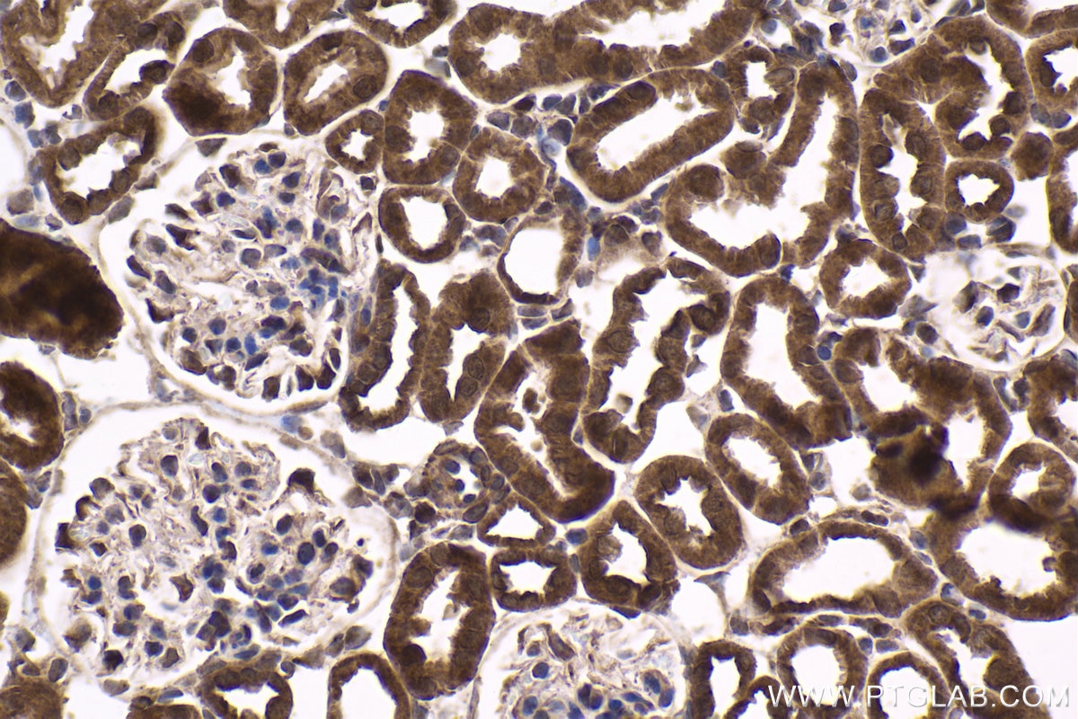 Immunohistochemical analysis of paraffin-embedded mouse kidney tissue slide using KHC1652 (RNF4 IHC Kit).