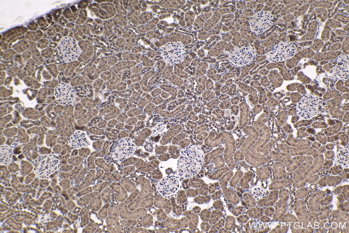 Immunohistochemical analysis of paraffin-embedded rat kidney tissue slide using KHC1652 (RNF4 IHC Kit).