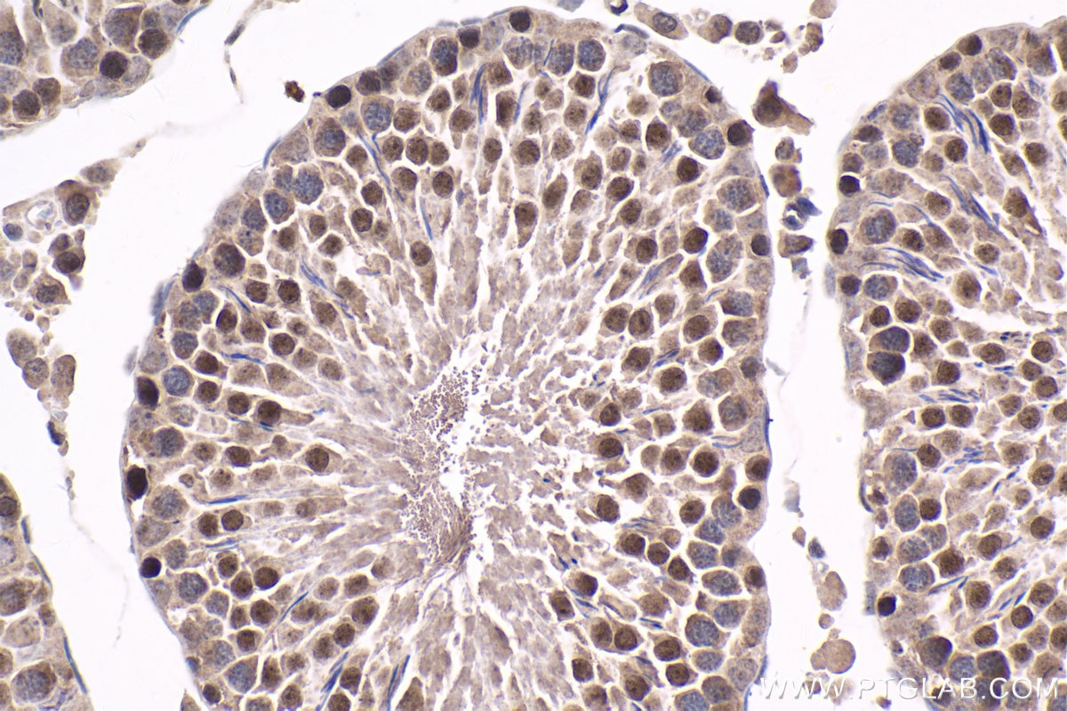 Immunohistochemical analysis of paraffin-embedded rat testis tissue slide using KHC1652 (RNF4 IHC Kit).