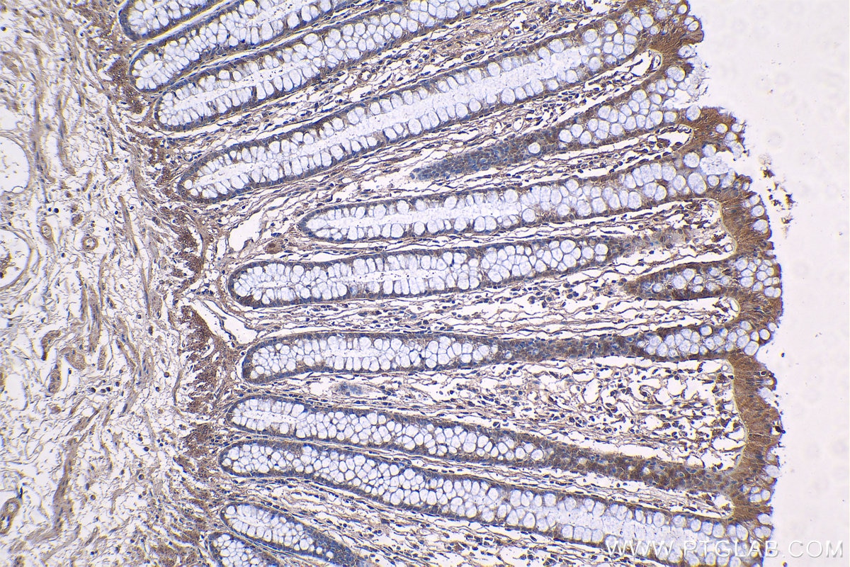 Immunohistochemical analysis of paraffin-embedded human colon tissue slide using KHC1243 (RNF6 IHC Kit).