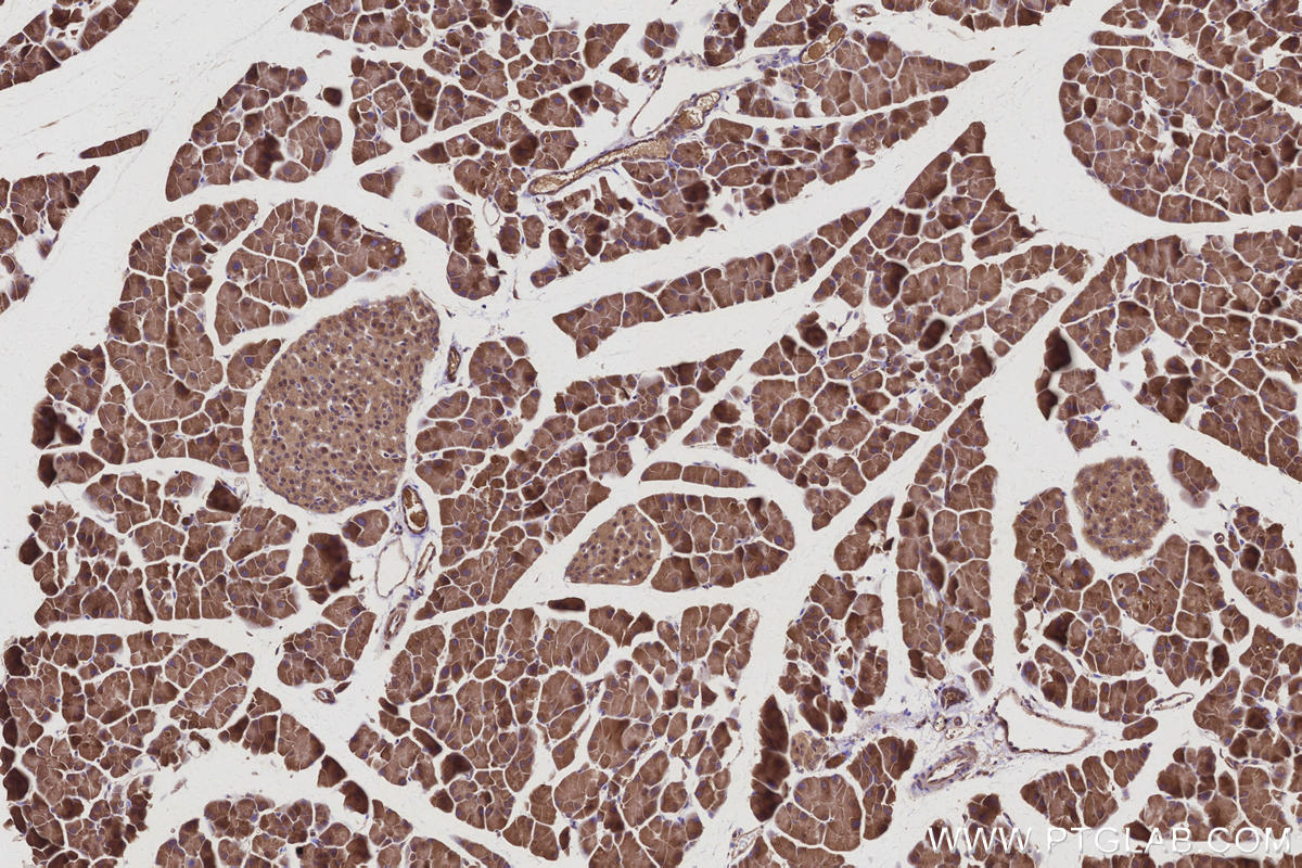 Immunohistochemical analysis of paraffin-embedded mouse pancreas tissue slide using KHC2998 (RNF7 IHC Kit). Immunohistochemical analysis of paraffin-embedded mouse pancreas tissue slide using KHC2998 (RNF7 IHC Kit).