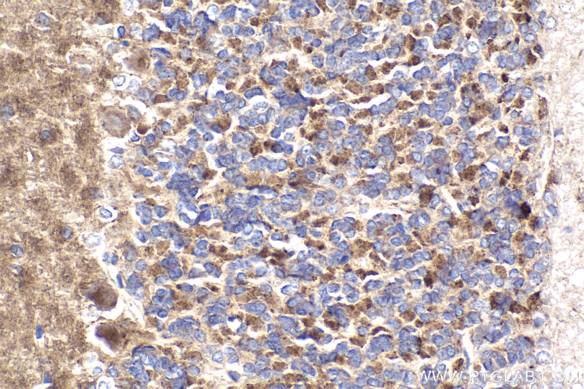 Immunohistochemical analysis of paraffin-embedded rat cerebellum tissue slide using KHC1917 (ROGDI IHC Kit).