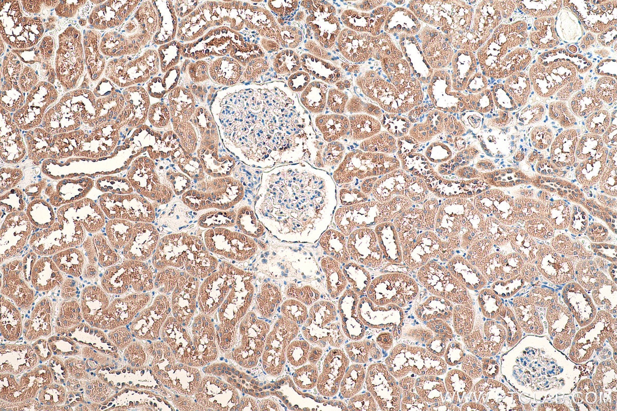 Immunohistochemical analysis of paraffin-embedded human kidney tissue slide using KHC0819 (ROR1 IHC Kit).