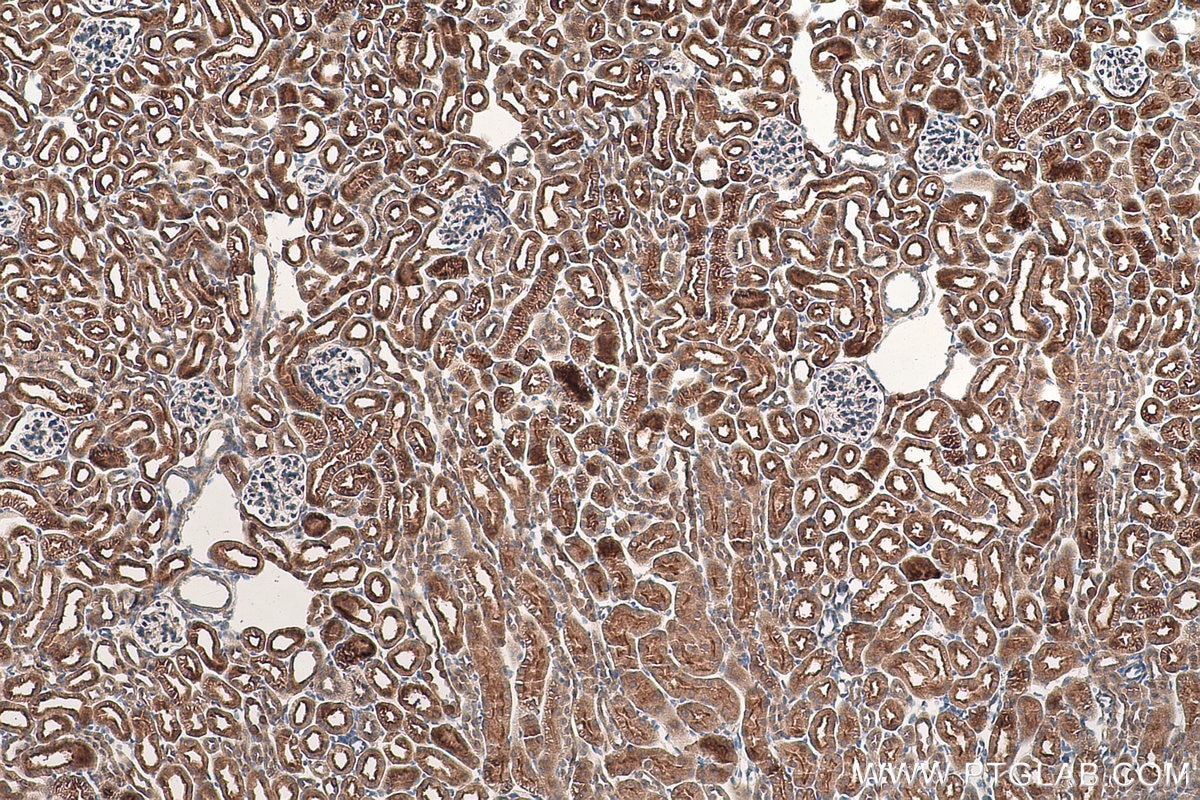 Immunohistochemical analysis of paraffin-embedded mouse kidney tissue slide using KHC0997 (RPAP3 IHC Kit).