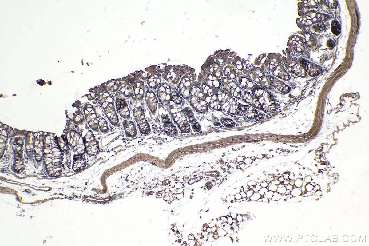 Immunohistochemical analysis of paraffin-embedded mouse colon tissue slide using KHC0997 (RPAP3 IHC Kit).