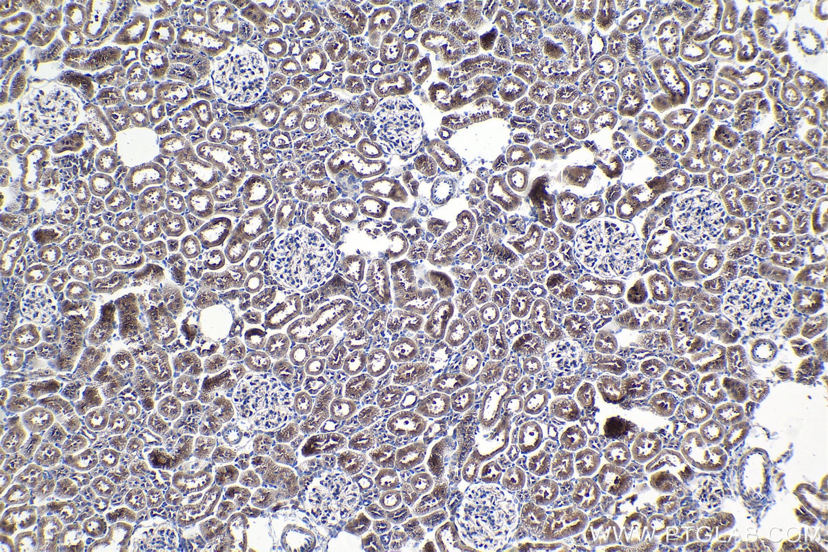 Immunohistochemical analysis of paraffin-embedded rat kidney tissue slide using KHC0997 (RPAP3 IHC Kit).