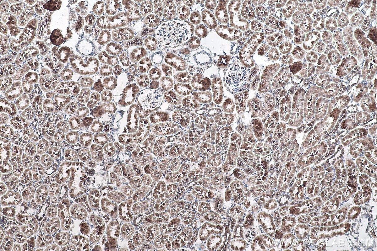 Immunohistochemical analysis of paraffin-embedded rat kidney tissue slide using KHC0900 (RPL13 IHC Kit).