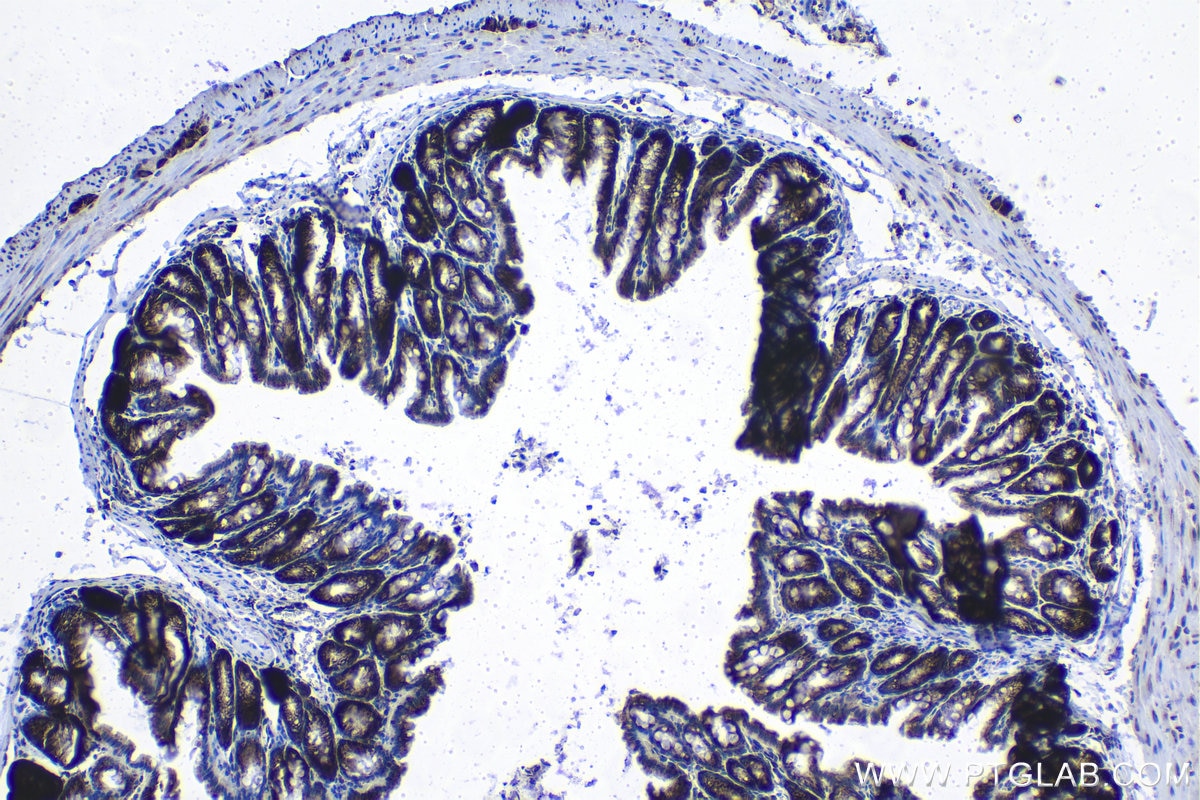 Immunohistochemical analysis of paraffin-embedded mouse colon tissue slide using KHC1372 (RPL14 IHC Kit).