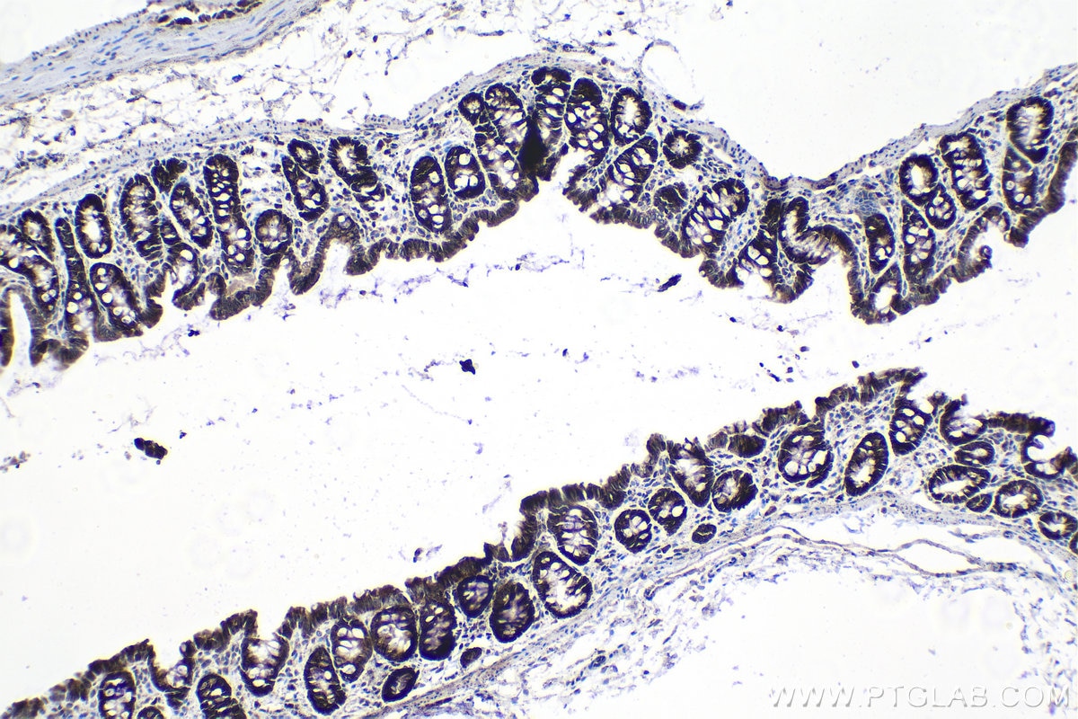 Immunohistochemical analysis of paraffin-embedded rat colon tissue slide using KHC1372 (RPL14 IHC Kit).