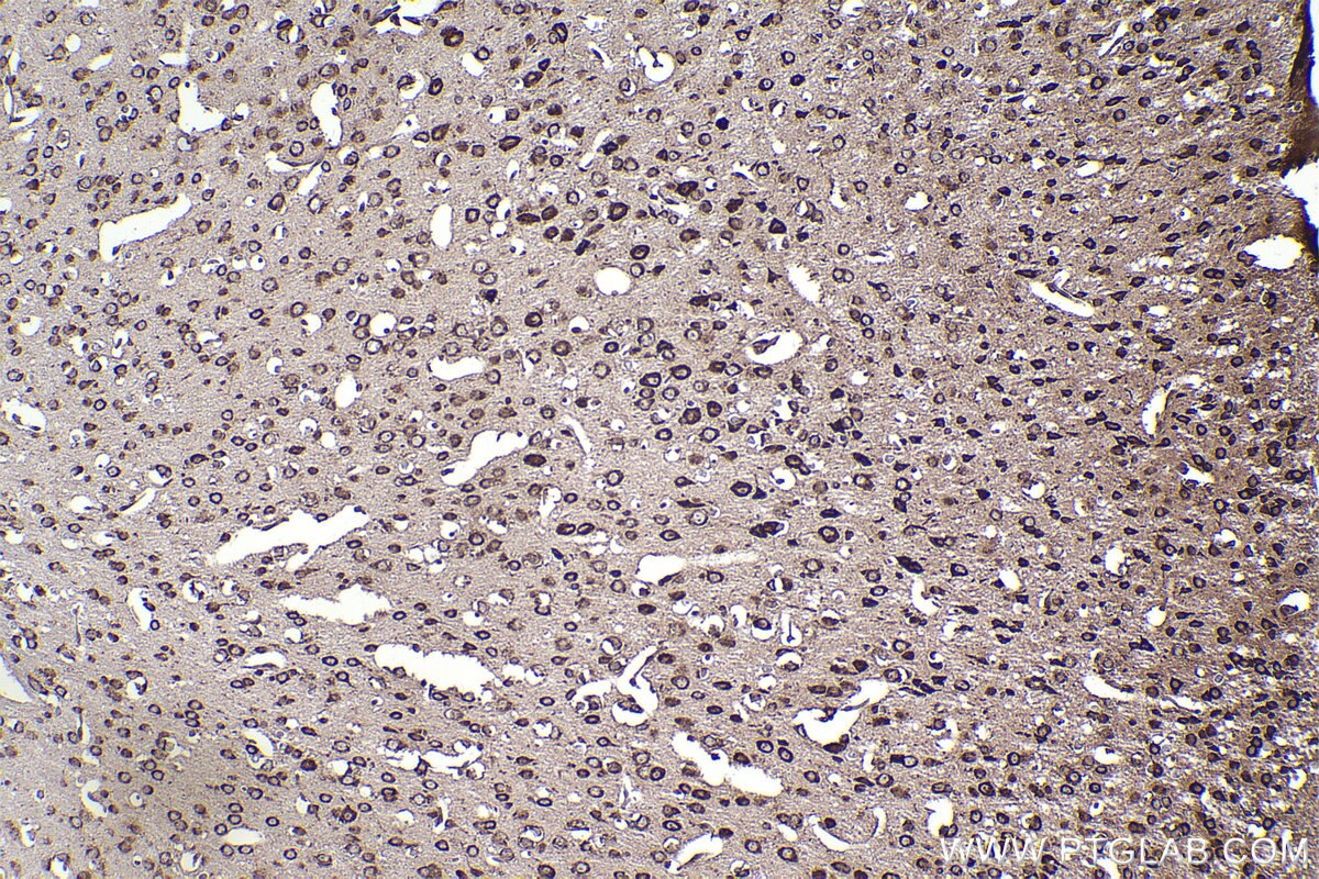Immunohistochemical analysis of paraffin-embedded mouse brain tissue slide using KHC2374 (RPL19 IHC Kit).