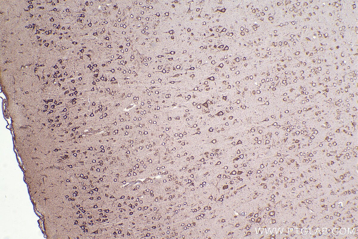 Immunohistochemical analysis of paraffin-embedded rat brain tissue slide using KHC2374 (RPL19 IHC Kit).