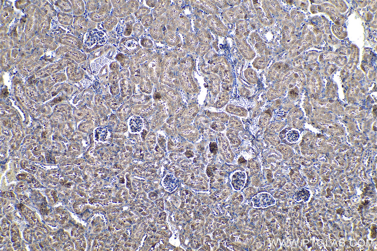 Immunohistochemical analysis of paraffin-embedded mouse kidney tissue slide using KHC0583 (RPL23A IHC Kit).