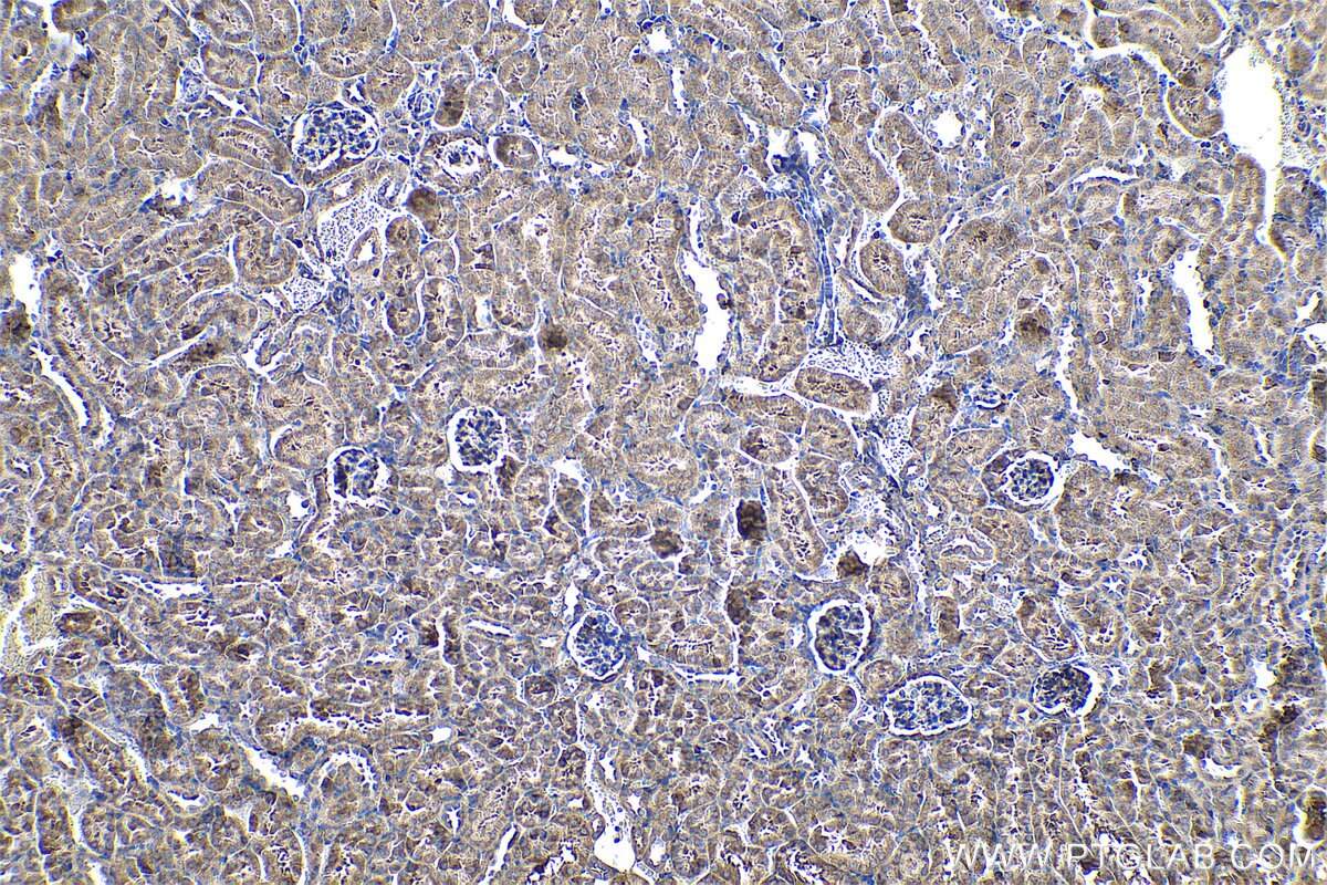 Immunohistochemical analysis of paraffin-embedded mouse kidney tissue slide using KHC0583 (RPL23A IHC Kit).