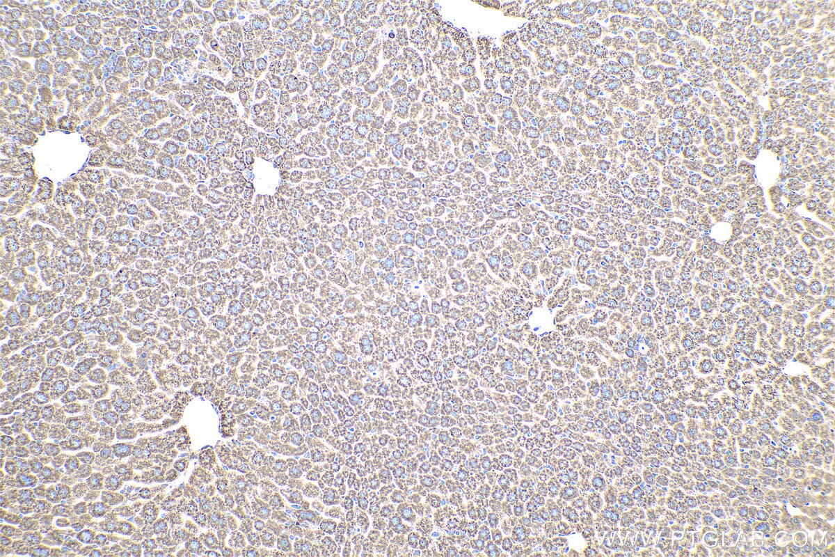 Immunohistochemical analysis of paraffin-embedded mouse liver tissue slide using KHC0583 (RPL23A IHC Kit).