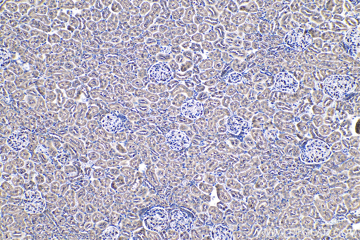 Immunohistochemical analysis of paraffin-embedded rat kidney tissue slide using KHC0583 (RPL23A IHC Kit).
