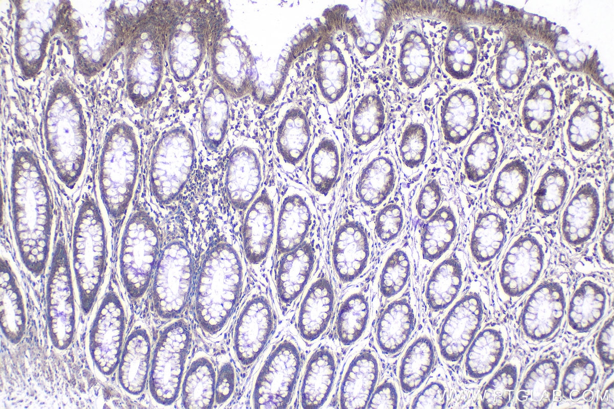 Immunohistochemical analysis of paraffin-embedded human colon tissue slide using KHC1144 (RPL31 IHC Kit).