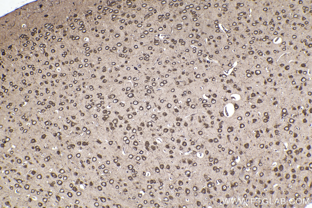 Immunohistochemical analysis of paraffin-embedded mouse brain tissue slide using KHC2253 (RPL4 IHC Kit).
