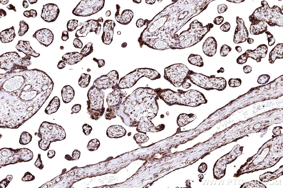 Immunohistochemical analysis of paraffin-embedded human placenta tissue slide using KHC3212 (RPL5 IHC Kit). Immunohistochemical analysis of paraffin-embedded human placenta tissue slide using KHC3212 (RPL5 IHC Kit).
