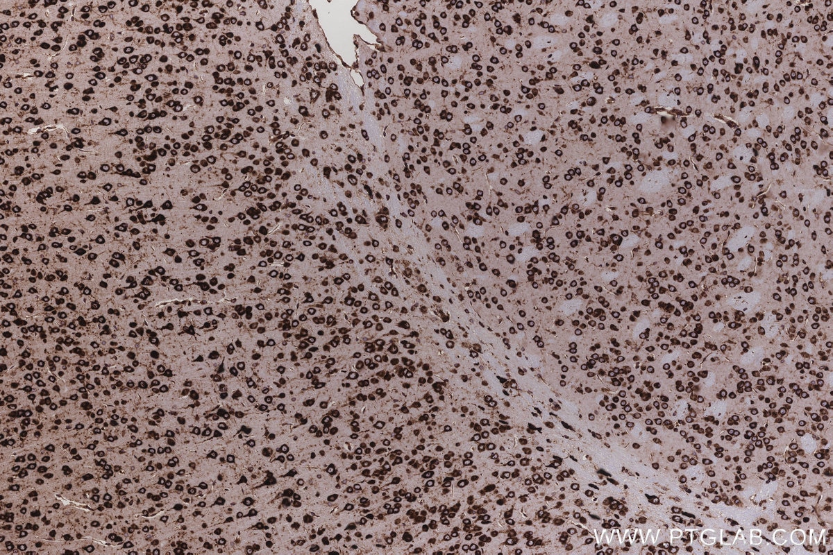 Immunohistochemical analysis of paraffin-embedded mouse brain tissue slide using KHC3212 (RPL5 IHC Kit). Immunohistochemical analysis of paraffin-embedded mouse brain tissue slide using KHC3212 (RPL5 IHC Kit).