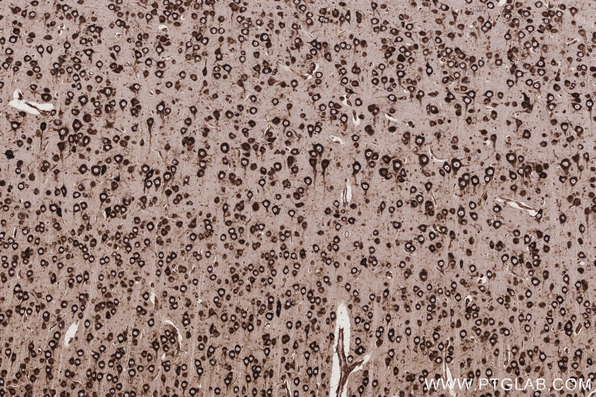 Immunohistochemical analysis of paraffin-embedded rat brain tissue slide using KHC3212 (RPL5 IHC Kit). Immunohistochemical analysis of paraffin-embedded rat brain tissue slide using KHC3212 (RPL5 IHC Kit).