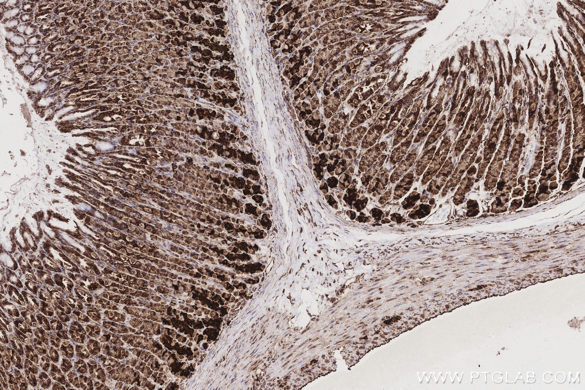 Immunohistochemical analysis of paraffin-embedded rat stomach tissue slide using KHC3212 (RPL5 IHC Kit). Immunohistochemical analysis of paraffin-embedded rat stomach tissue slide using KHC3212 (RPL5 IHC Kit).