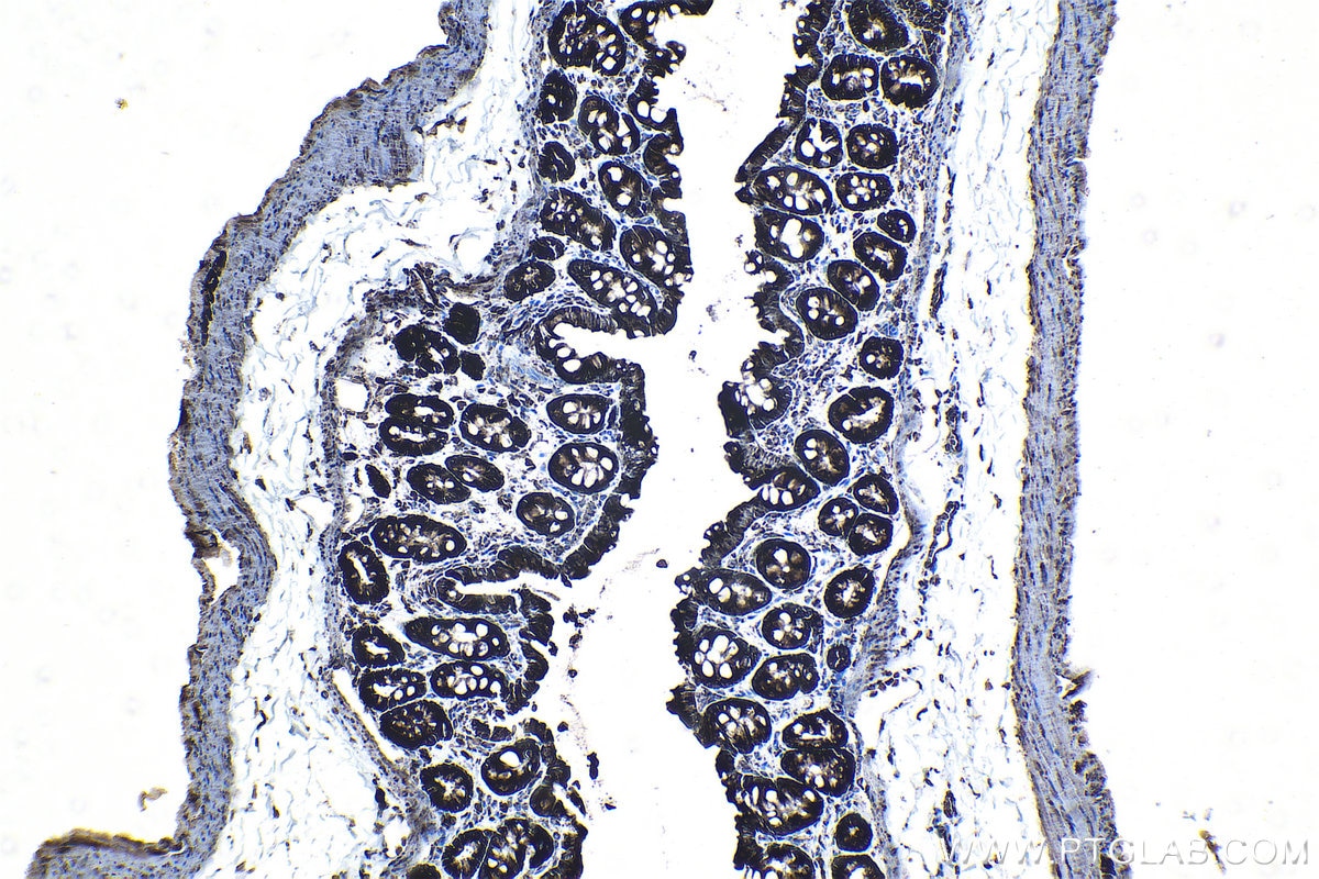 Immunohistochemical analysis of paraffin-embedded rat colon tissue slide using KHC1265 (RPL7A IHC Kit).