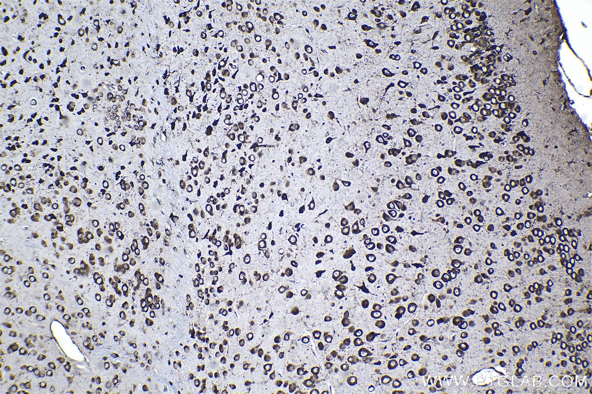 Immunohistochemical analysis of paraffin-embedded mouse brain tissue slide using KHC1265 (RPL7A IHC Kit).
