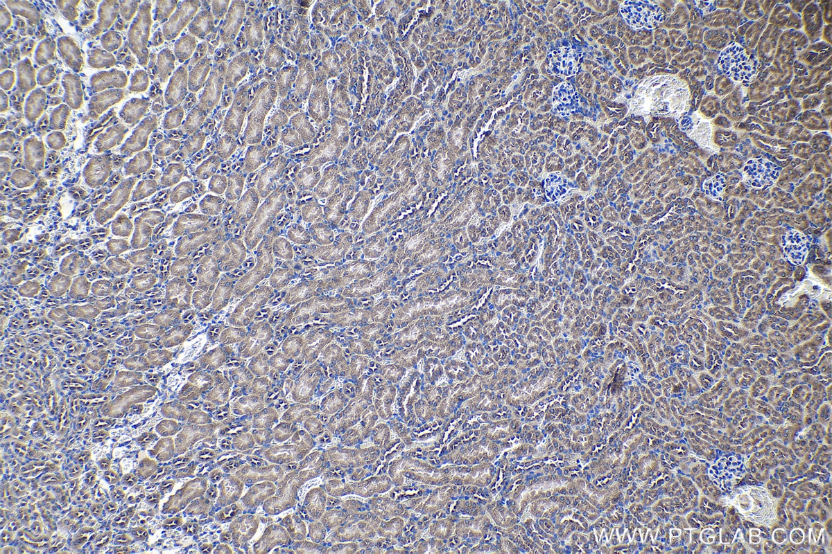 Immunohistochemical analysis of paraffin-embedded mouse kidney tissue slide using KHC1145 (RPLP0 IHC Kit).