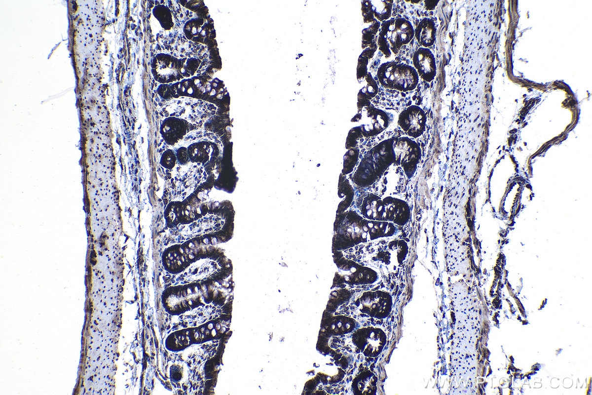 Immunohistochemical analysis of paraffin-embedded rat colon tissue slide using KHC1145 (RPLP0 IHC Kit).