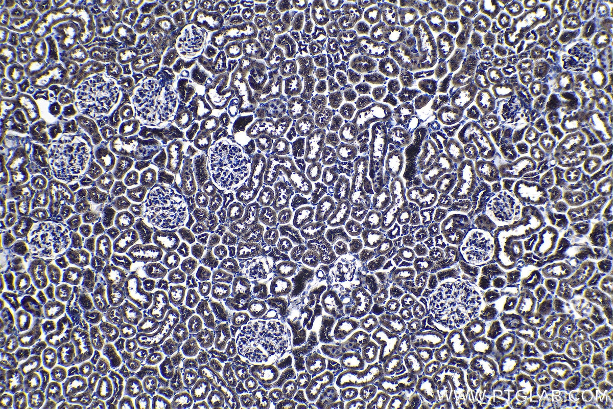 Immunohistochemical analysis of paraffin-embedded rat kidney tissue slide using KHC1145 (RPLP0 IHC Kit).