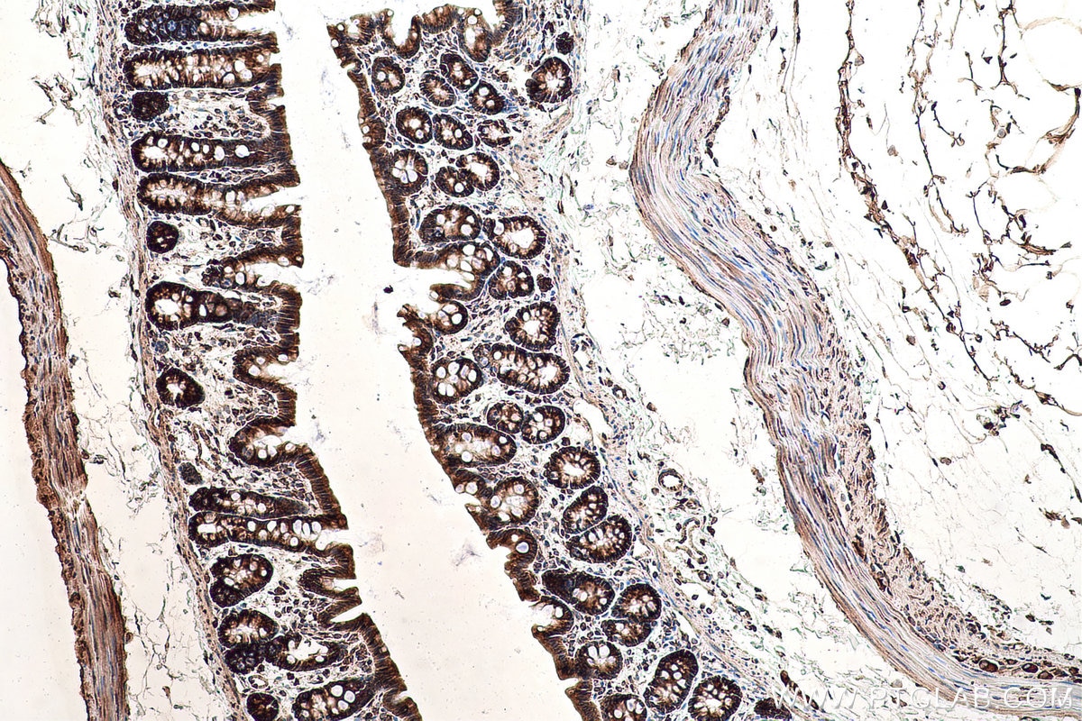 Immunohistochemical analysis of paraffin-embedded rat colon tissue slide using KHC0831 (RPLP1 IHC Kit).